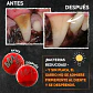 Zupet Qchefs-snack Dental Aliento Perro-crocante-mmini-72 Gr. - Miniatura 5