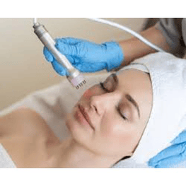 Facial Expres+Radio Frecuencia Facial.