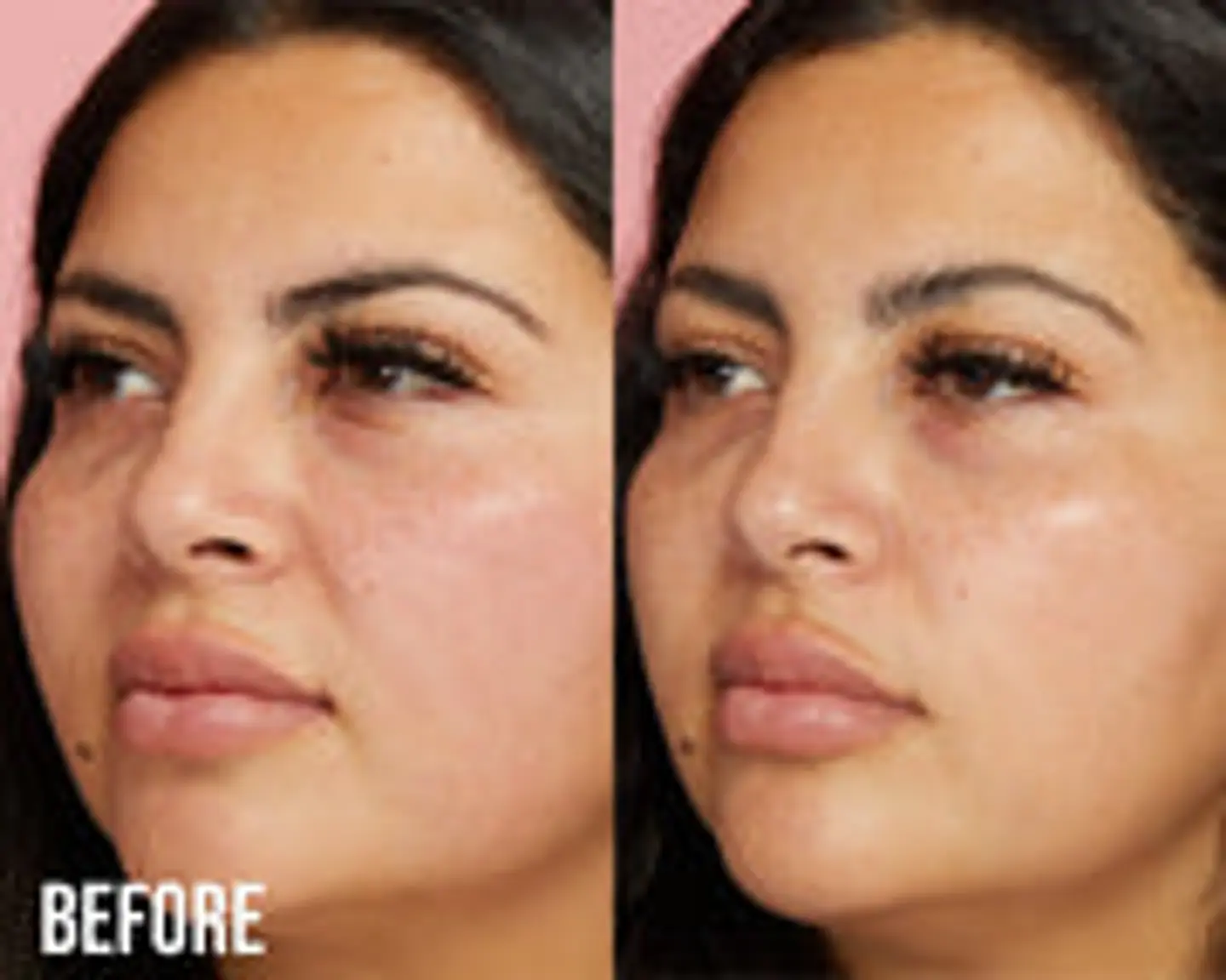 Suero Hidratante con Gotero Beauty Creations unidad  3