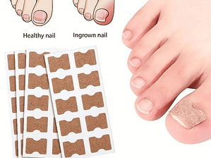 Parches Para Corregir Uña Encarnada