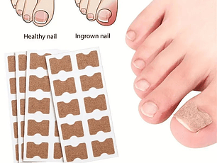 Parches Para Corregir Uña Encarnada