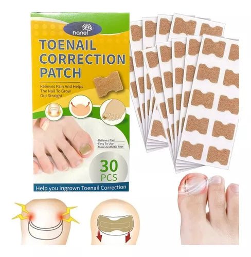 Parches Para Corregir Uña Encarnada 3