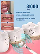 Cepillo Dental Eléctrico Kit Limpiador De Dientes Ultrasónico Mohits Removedor De Sarro Portátil Usb Blanco - Miniatura 2
