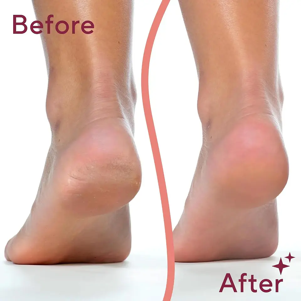 Exfoliadores y limas electrónicas para manicura y pedicura Electric Pedi Removedor Dureza 3