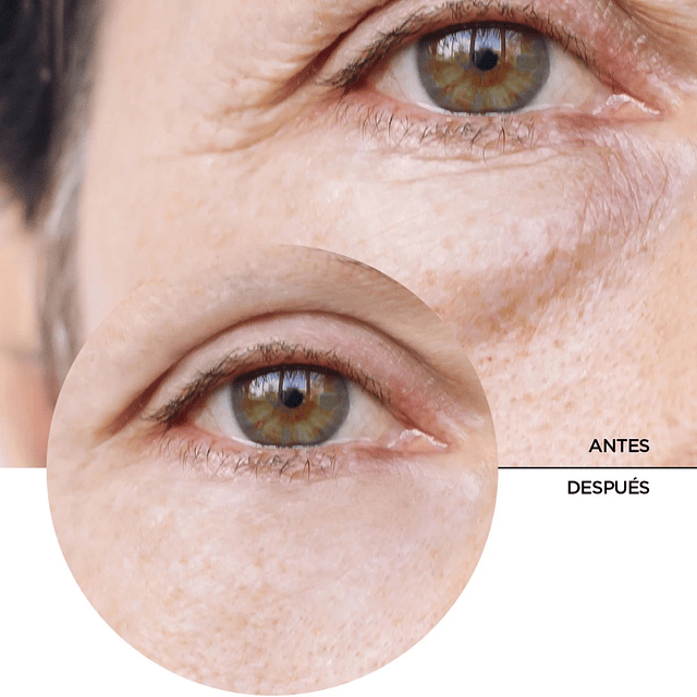 Serum Contorno de Ojos Revox B77 Just Caffeine 5% – 30 ml