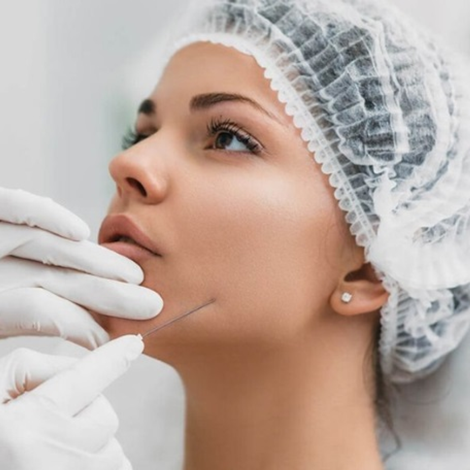 Hilos revitalizantes PDO