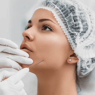 Hilos revitalizantes PDO