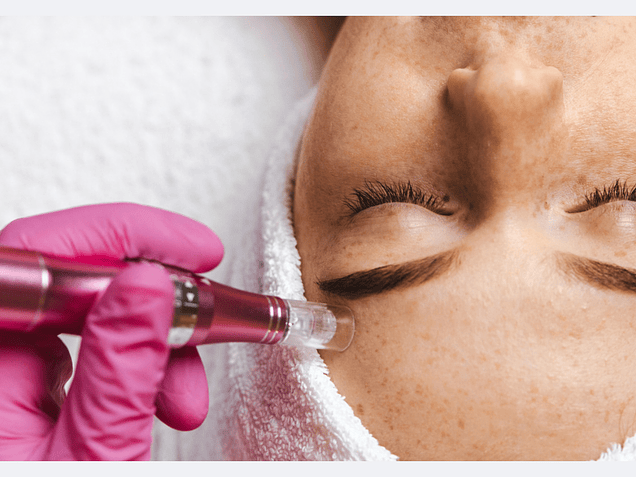 Mesoterapia Facial