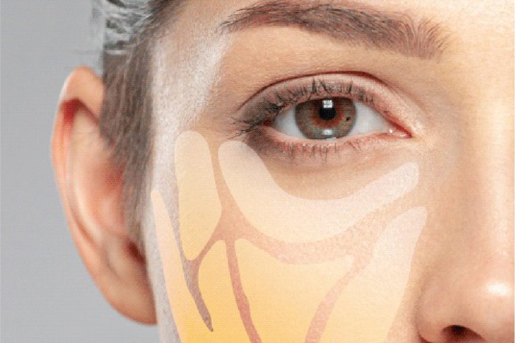 Adipoestructuración Facial