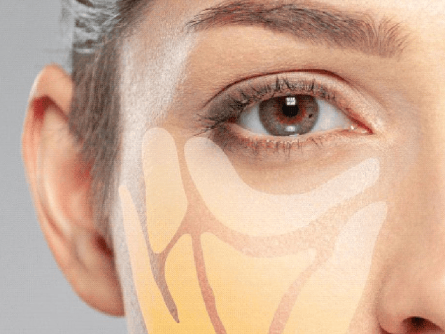 Adipoestructuración Facial