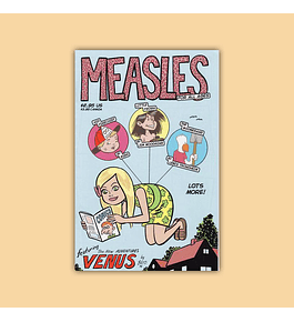 Measles 1 1998