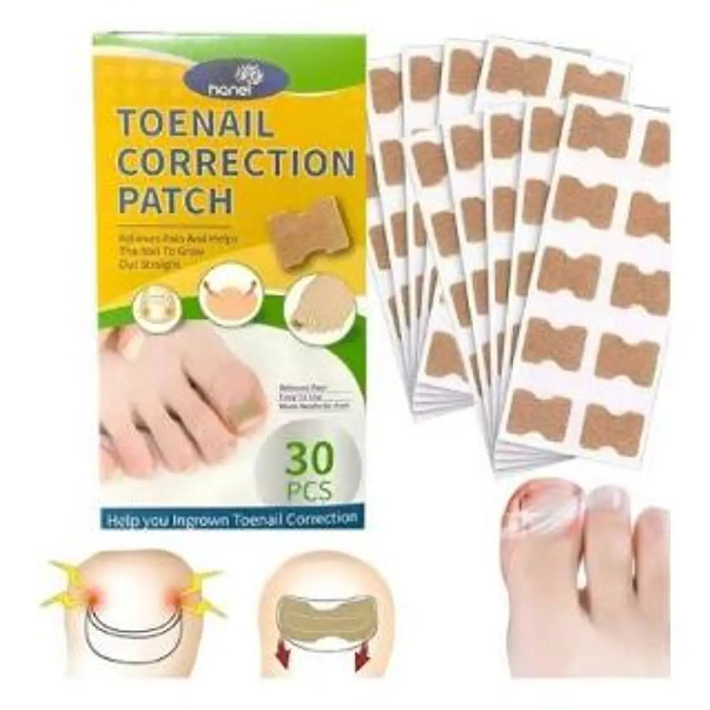 Parches para uñas encarnadas