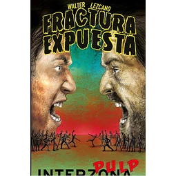 Fractura Expuesta Walter Lezcano