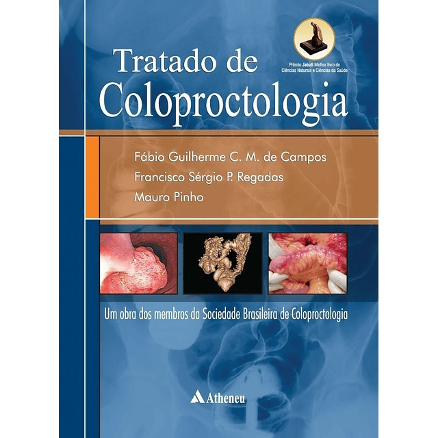 Tratado De Coloproctologia