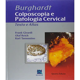 Burghardt Colposcopia E Patologia Cervical