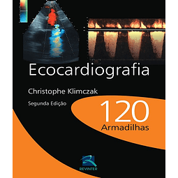Ecocardiografia 120 Armadilhas 02 Ed