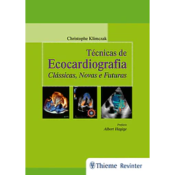 Técnicas De Ecocardiografia Clássicas Novas E Futuras