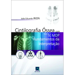 Cintilografia Óssea Com 99m Tc Mdp Fundamentos Da Interpre