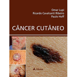 Cancer Cutaneo
