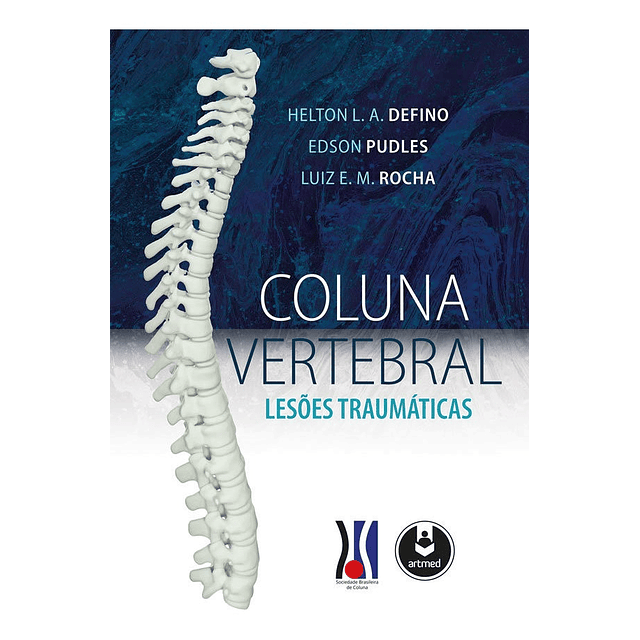 Coluna Vertebral Lesões Traumáticas