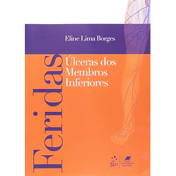 Feridas Ulceras De Membros Inferiores