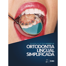 Ortodontia Lingual Simplificada