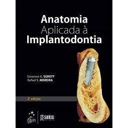 Anatomia Aplicada A Implantodontia 02 Ed