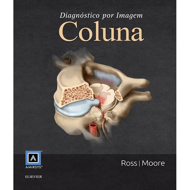 Coluna Diagnostico Por Imagem 03 Ed