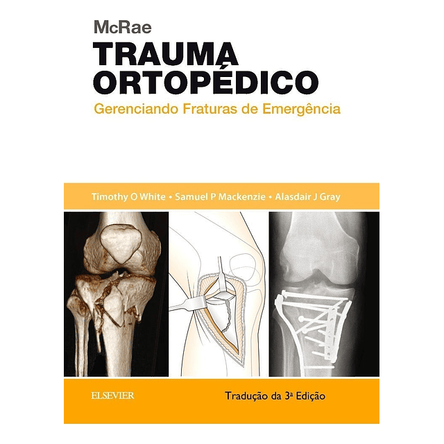 Trauma Ortopedico Mcrae