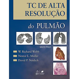 Tc De Alta Resolução Do Pulmão