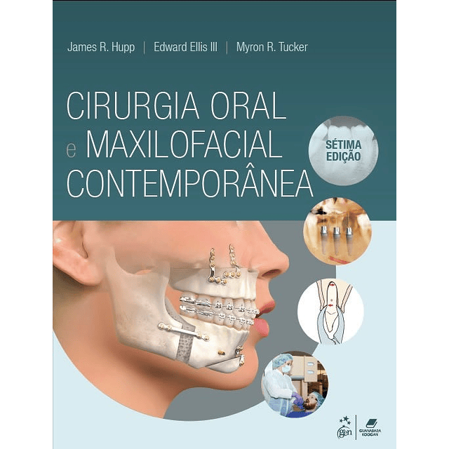 Cirurgia Oral E Maxilofacial Contemporânea