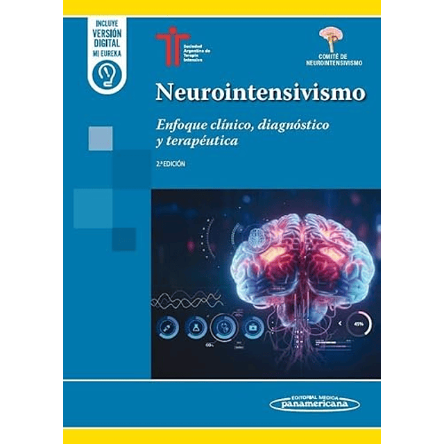 Neurointensivismo