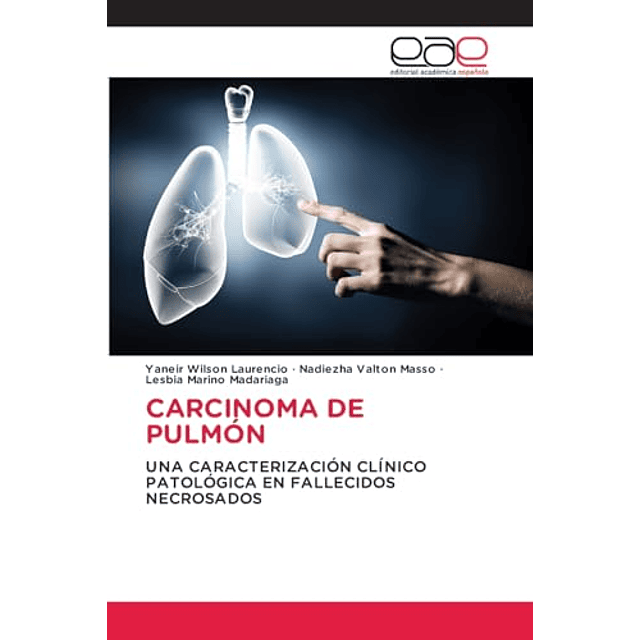 CARCINOMA DE PULMON