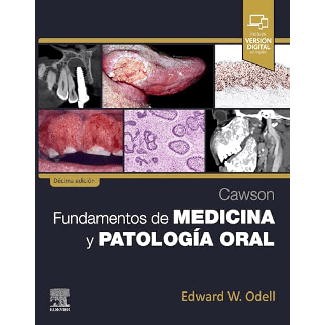 Cawson fundamentos de medicina y patologia oral