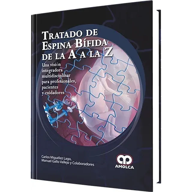 Tratado de espina bífida de la A a la Z
