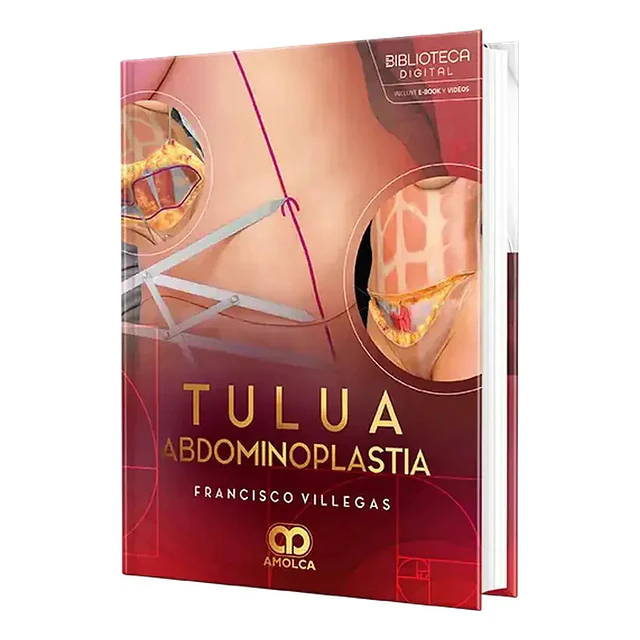 Tulua abdominoplastia