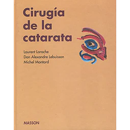 Cirugía de la catarata