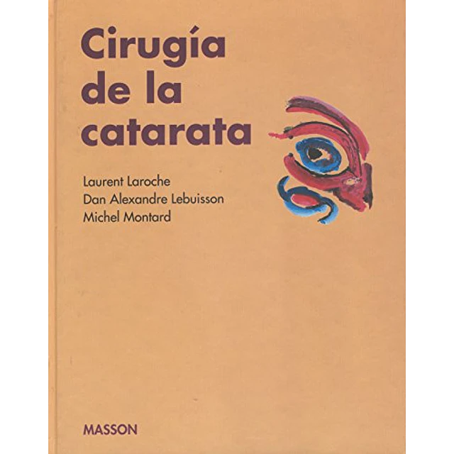 Cirugía de la catarata