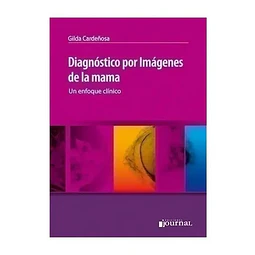 Diagnóstico por imagenes de la mama