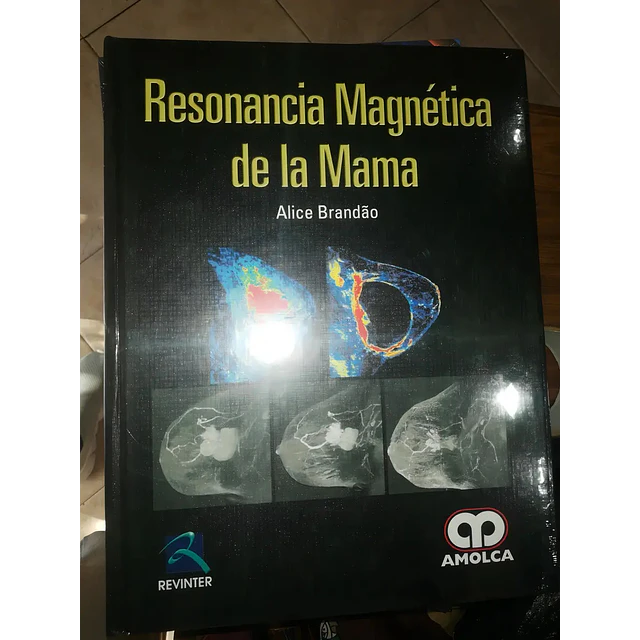 Resonancia Magnética de la Mama