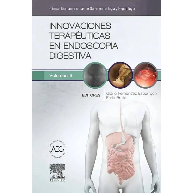 Innovaciones Terapéuticas en Endoscopia Digestiva