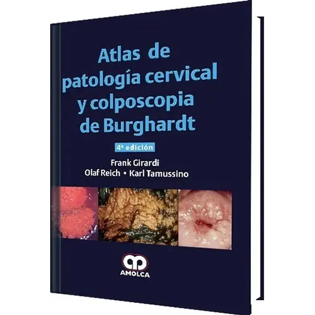 Atlas de patología cervical y colposcopia de Burghardt