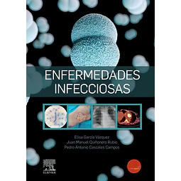 Enfermedades infecciosas