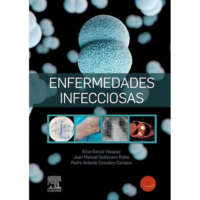 Enfermedades infecciosas