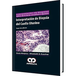 Interpretación de Biopsia del Cuello Uterino