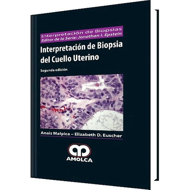 Interpretación de Biopsia del Cuello Uterino