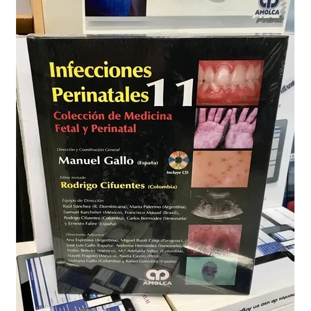 Infecciones Perinatales