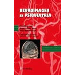 Neuroimagen en psiquiatría