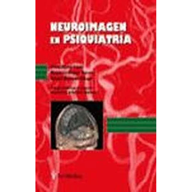 Neuroimagen en psiquiatría