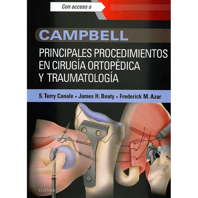 Campbell Principales Procedimientos en Cirugía Ortopédica y Traumatología